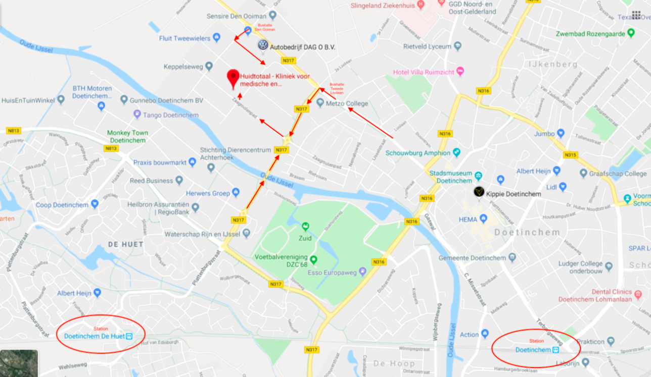 Huidtotaal Doetinchem Route